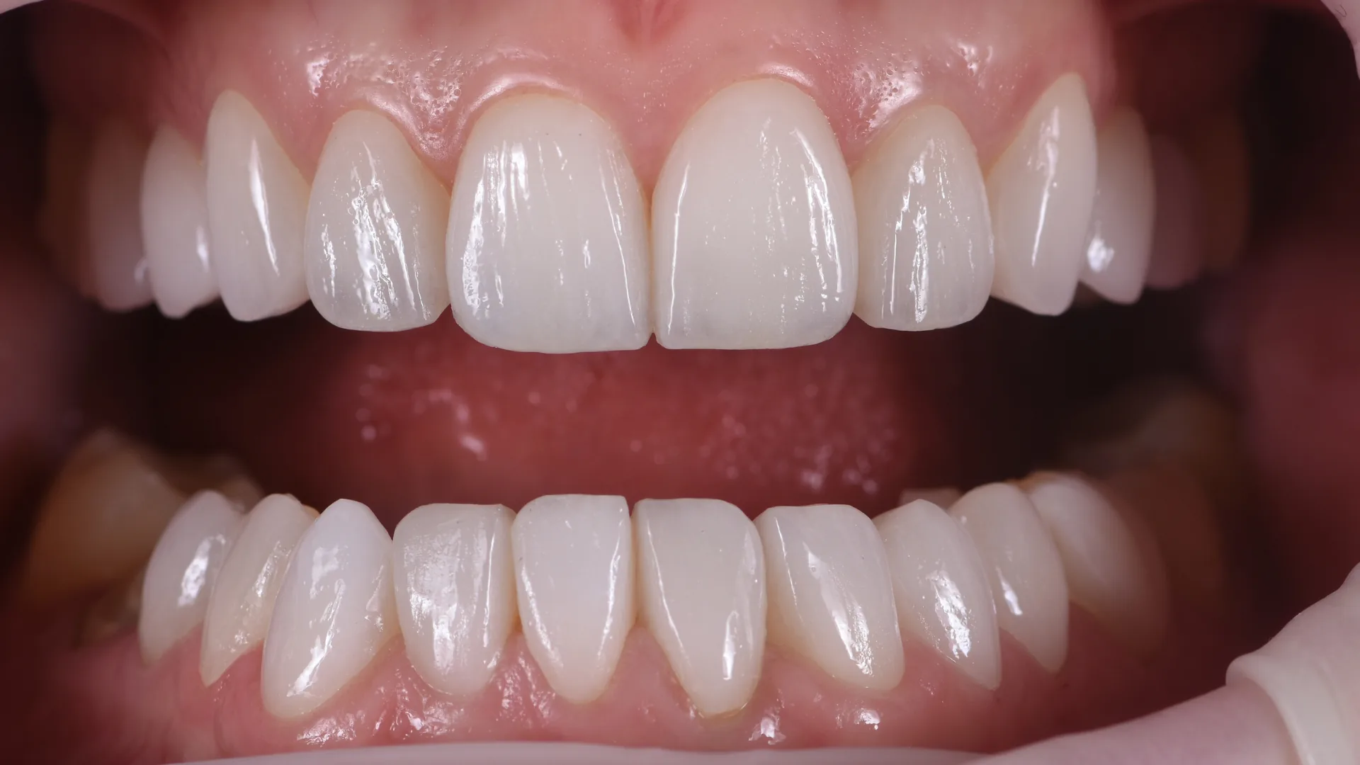 Before treatment