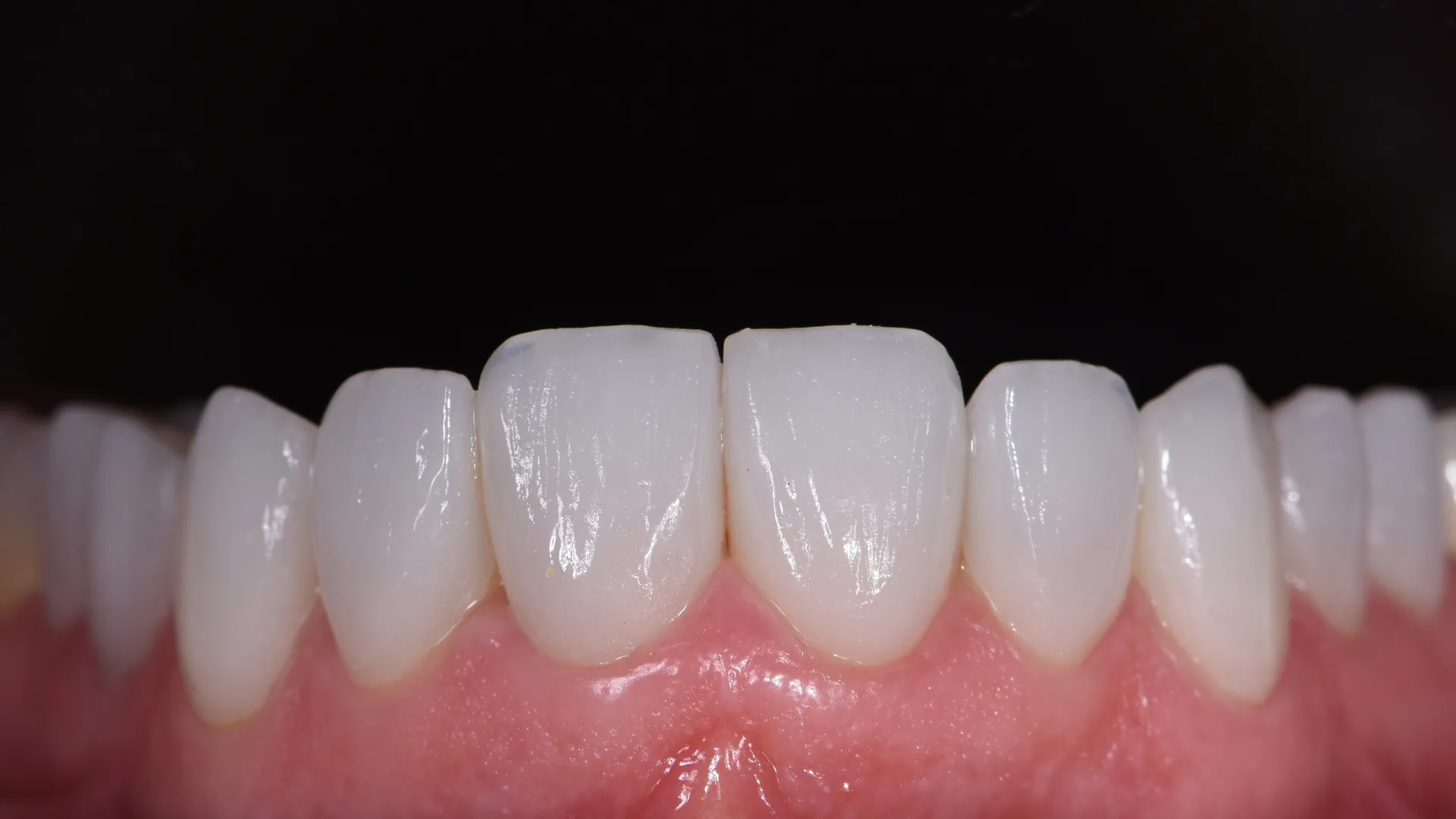 After treatment